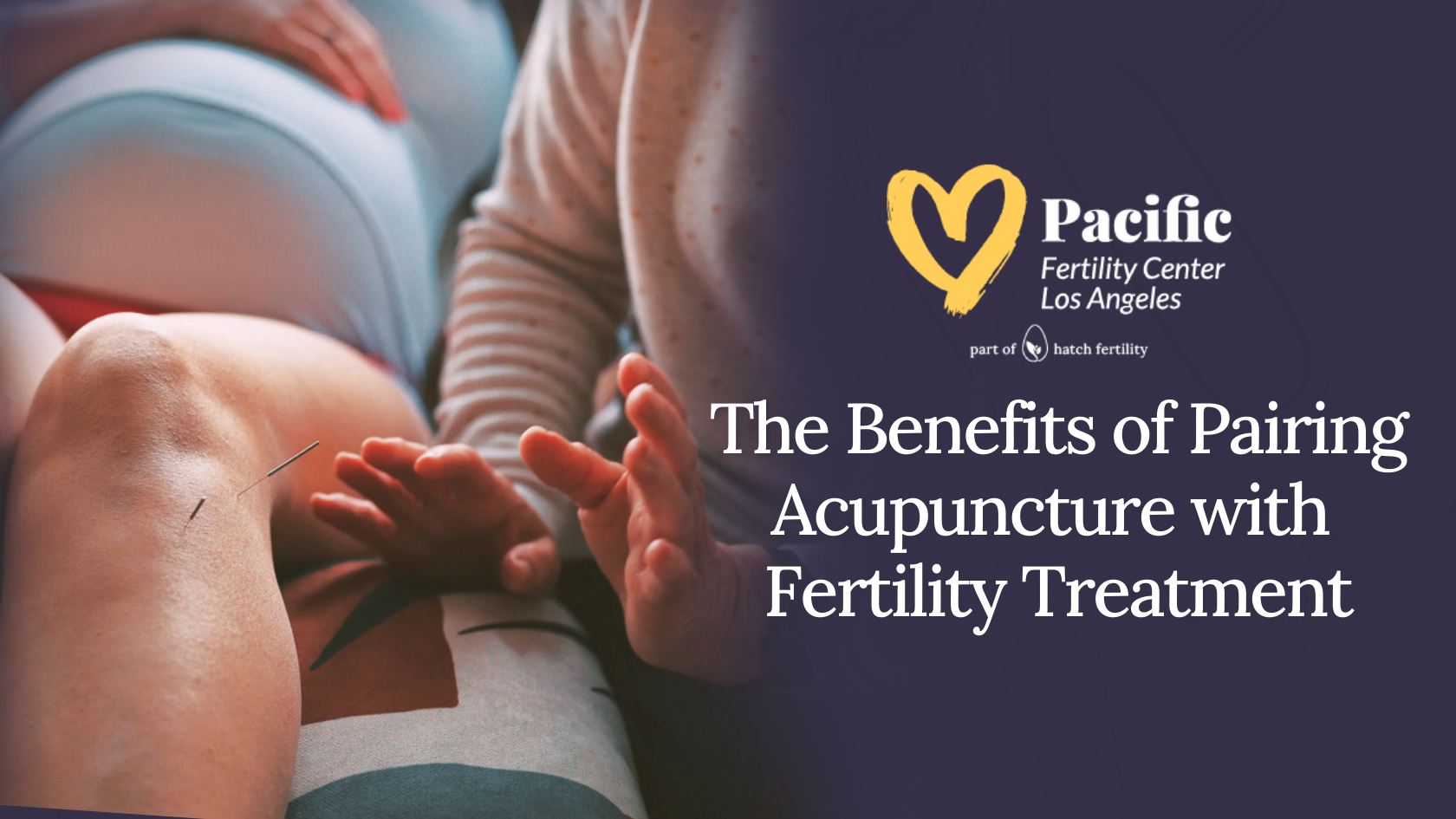 The Benefits of Pairing Acupuncture with Fertility Treatment